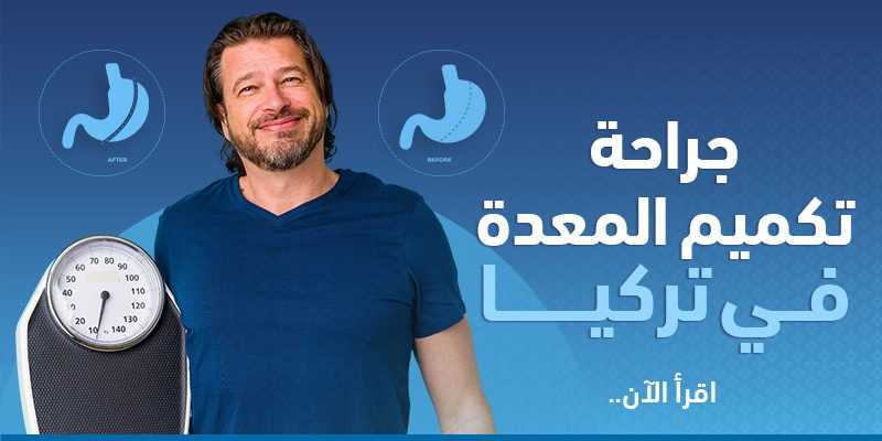 جراحة تكميم المعدة