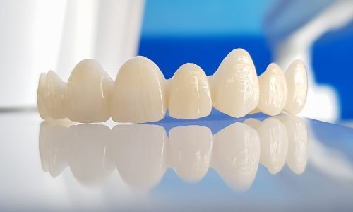 Dental crowns